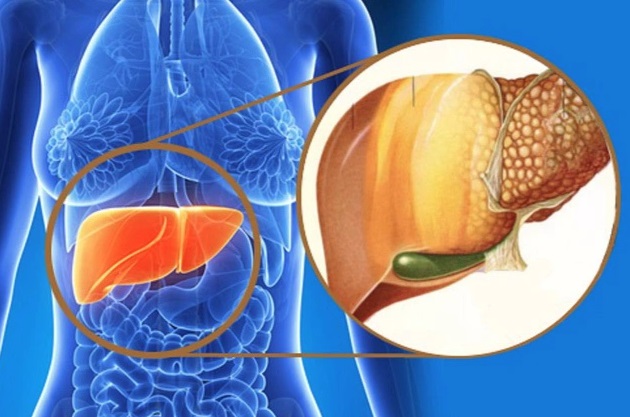 7 ຄວາມຜິດພາດເມື່ອຂັບລ້າງສານພິດໃນຕັບທີ່ເຮັດໃຫ້ຕັບອ່ອນເພຍ ແລະອ່ອນເພຍ - ຮູບ 3. 7 sai lầm khi thải độc gan khiến gan của bạn ngày càng yếu đi - Ảnh 3.