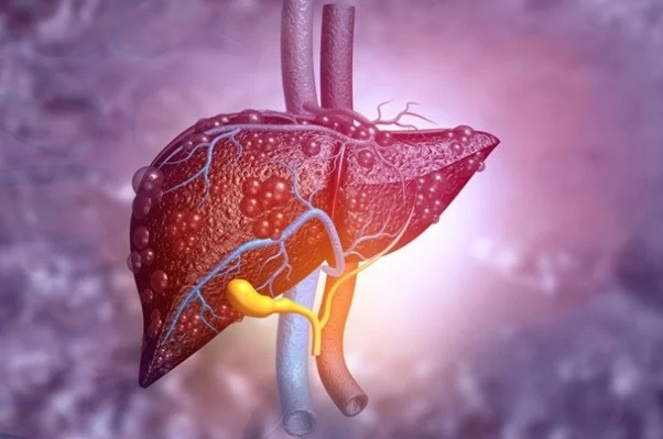 ລ້າງພິດຕັບຫຼັງເຕດ ດ້ວຍອາຫານຖືກ, ປອດໄພ ແລະ ມີປະສິດທິຜົນ, ຊາວຫວຽດນາມ ຫຼາຍຄົນບໍ່ສົນໃຈ - ຮູບ 2. Thải độc gan sau Tết bằng thực phẩm rẻ tiền, an toàn và hiệu quả, rất nhiều người Việt bỏ qua- Ảnh 2.